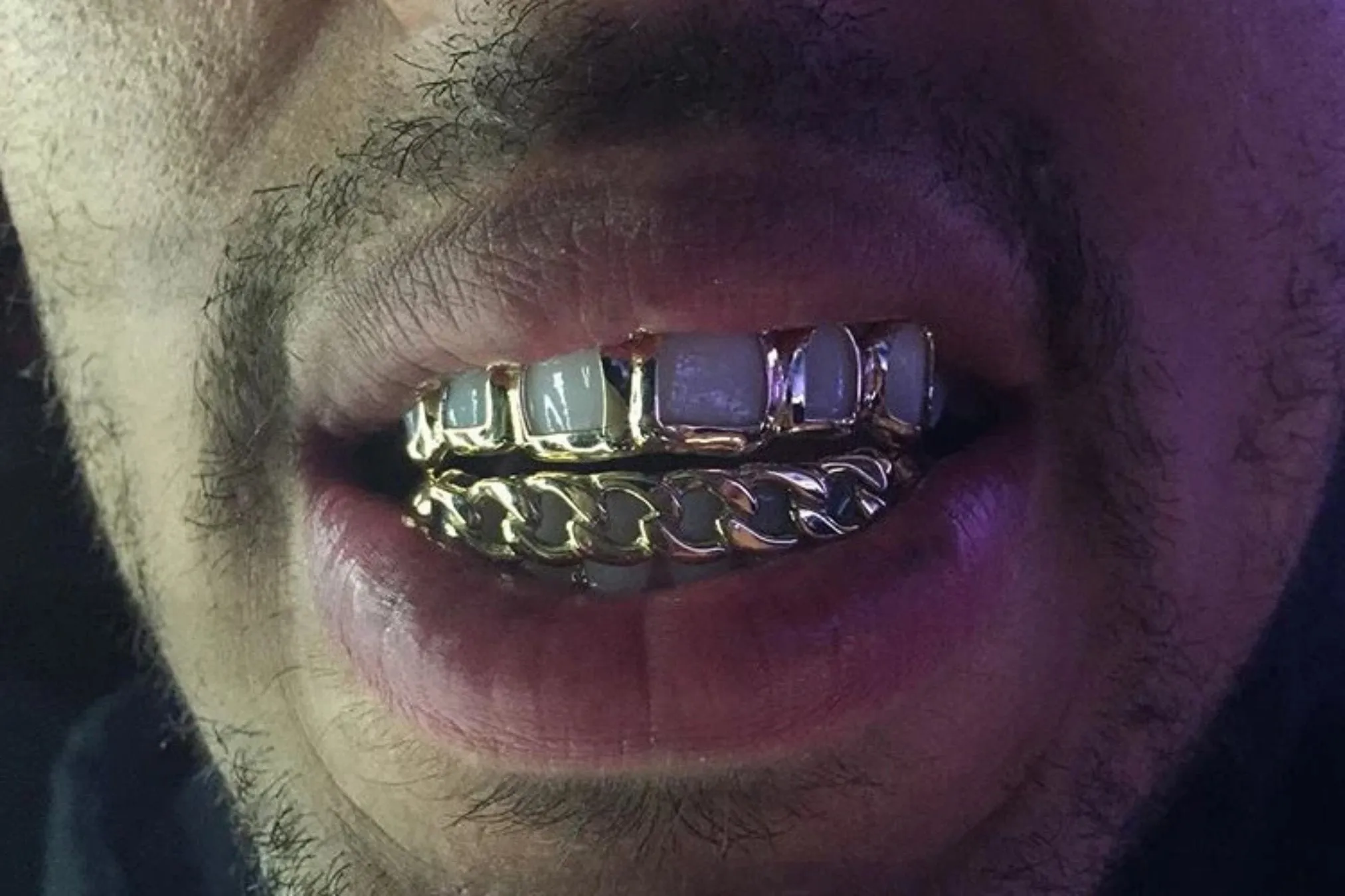 Custom Miami Cuban Link Solid Gold Grillz